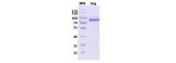 MousePAD2 Protein-arginine deiminase type-2 Mouse Recombinant Protein-10 ug